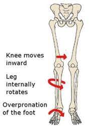 knee physical therapy Charlotte