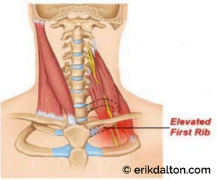 Melt Away Tension In Your Upper Traps And Shoulders [FAST RELIEF] 